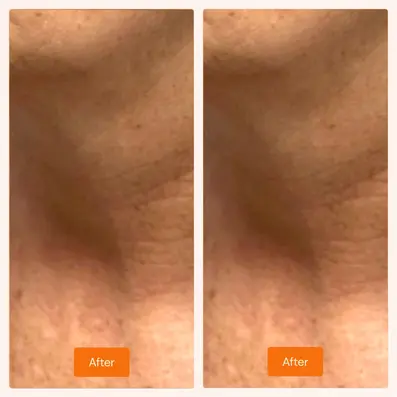 Facial care photo